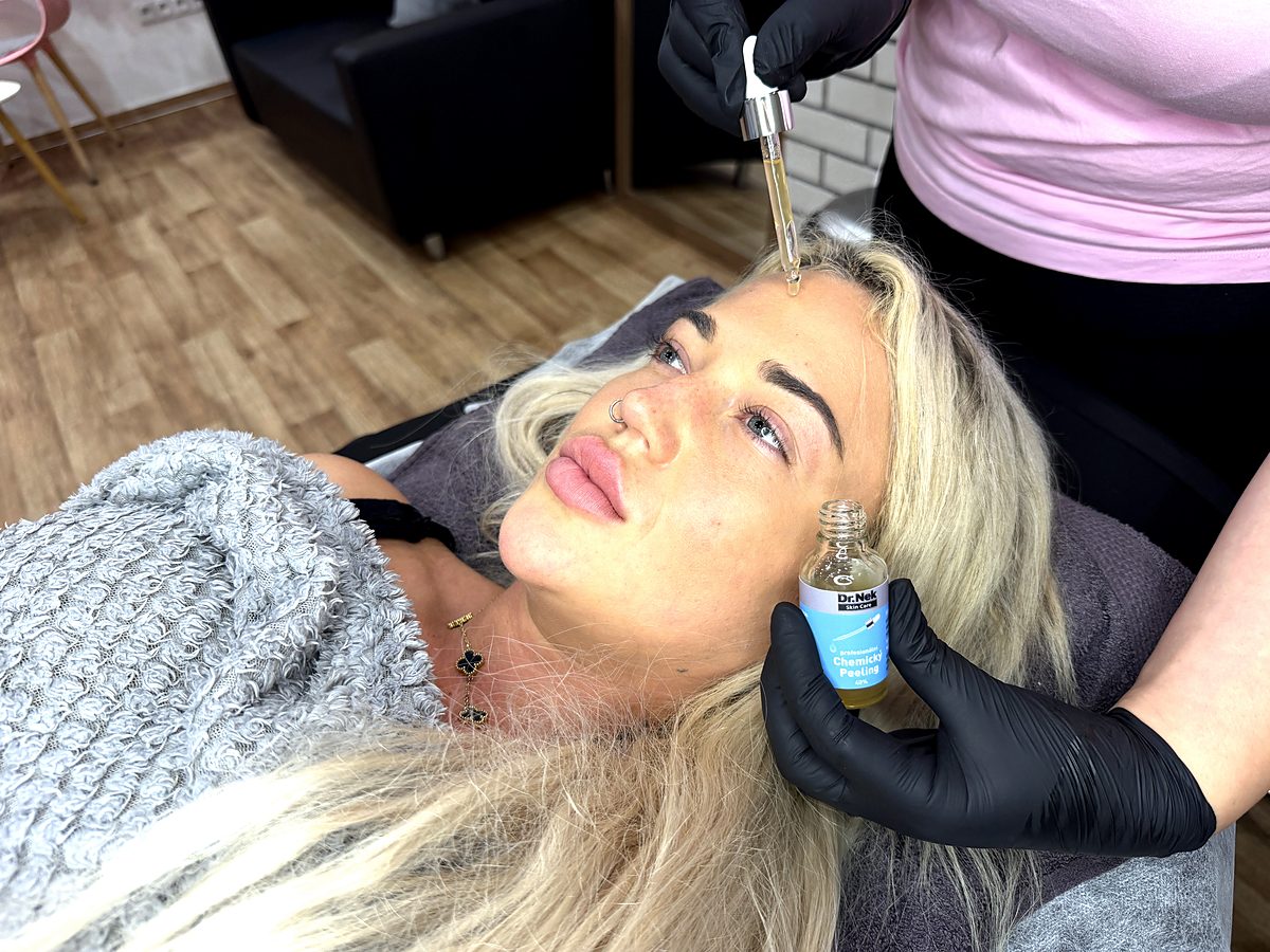 Curso online de peeling químico
