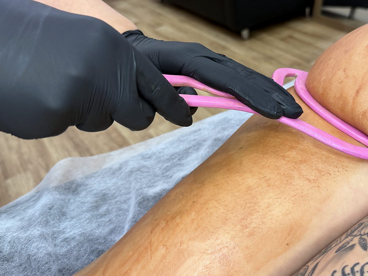 Curso online de Ice & Metal Therapy